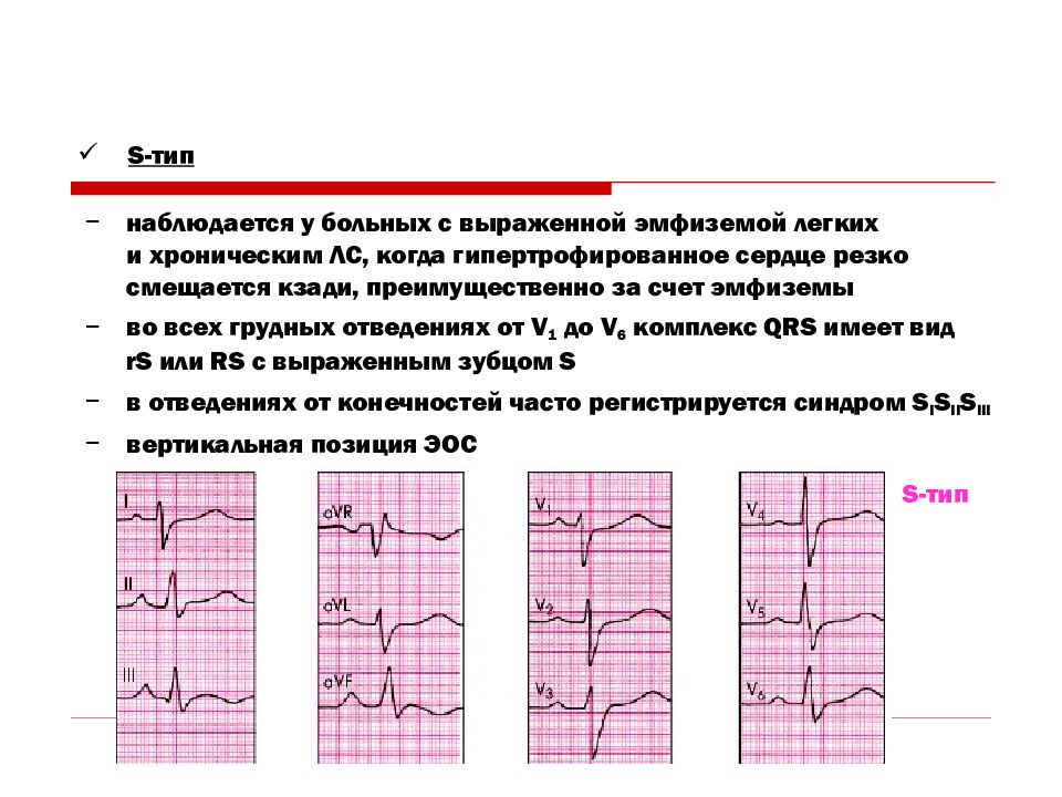 Хроническое легочное сердце презентация