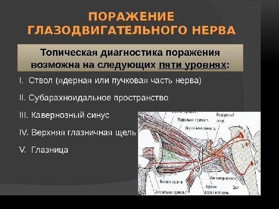 Презентация глазодвигательный нерв