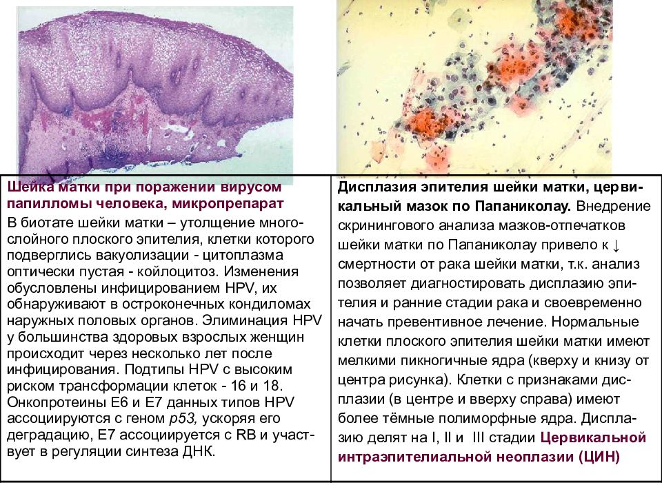 Впч презентация акушерство и гинекология