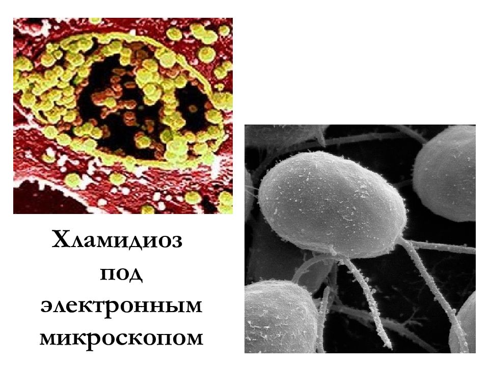 Хламидия chlamydia. Хламидии электронная микроскопия. Хламидия трахоматис микроскопия. Хламидии форма бактерии.