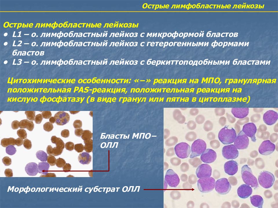 Презентация на тему гемобластозы