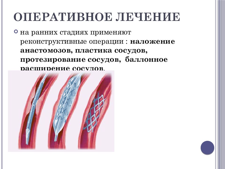 Сосудов нижних. Облитерирующие заболевания сосудов конечностей. Облитерирующий атеросклероз клиника. Облитерирующие заболевания сосудов нижних. Облитерирующие поражения артерий хирургия.