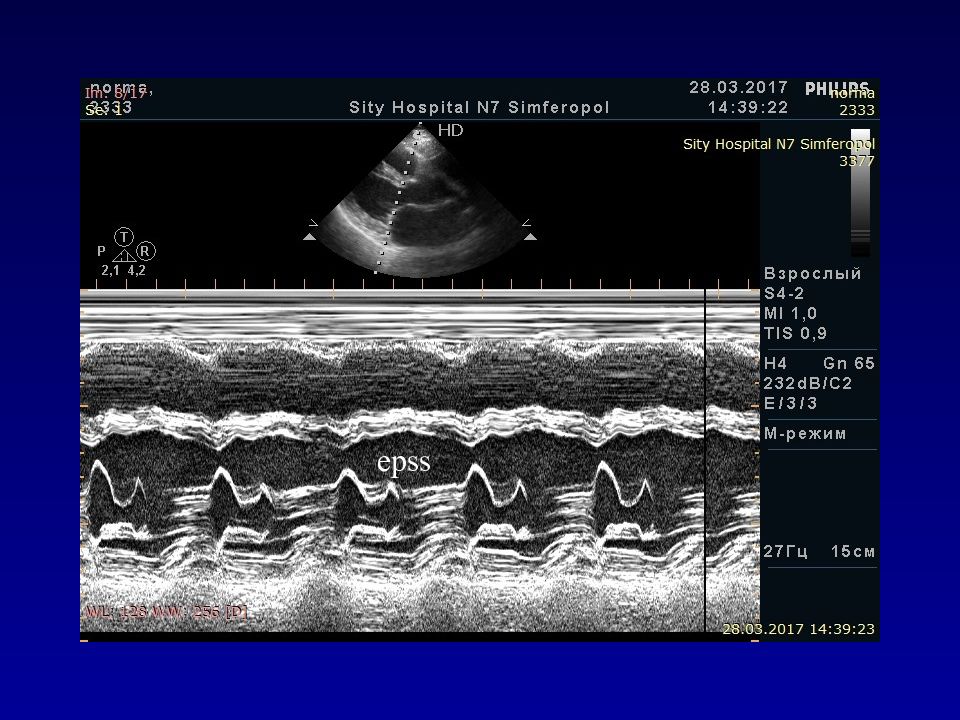 Учебный план эхокардиография