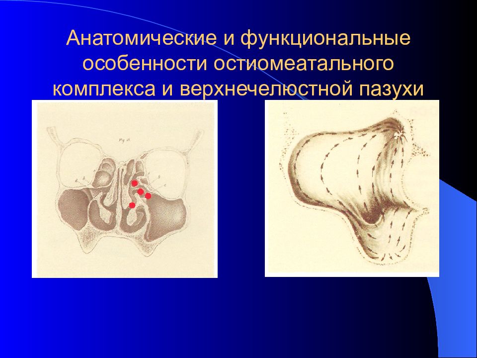 Острые и хронические синуситы презентация