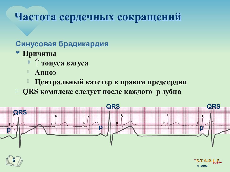перебои в работе сердца симптомы. сердце работает с перебоями. ощущение перебоев в работе сердца. пропуск удара. перебои в работе сердца лечение.