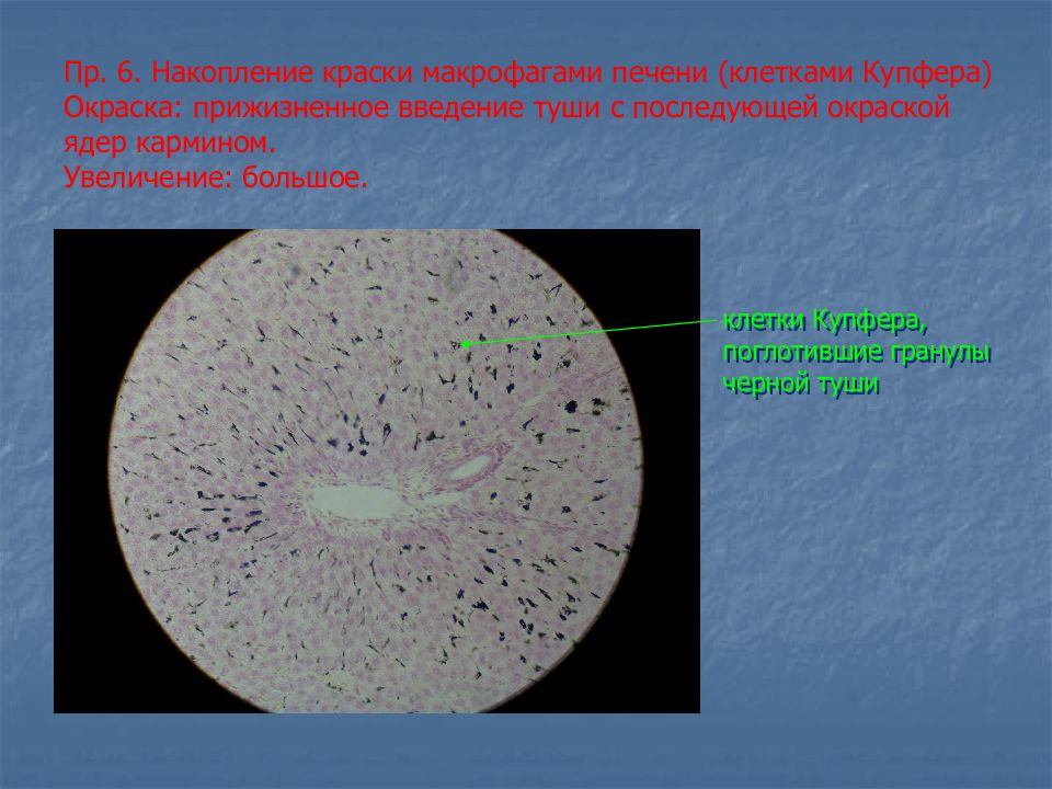 Клетки накопления. Клетки Купфера в печени гистология. Макрофаги печени гистология. Макрофаги печени гистология препарат. Макрофаги Купфера гистология.