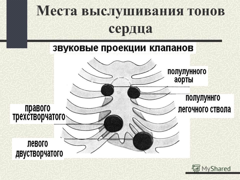 Тоны сердца картинки