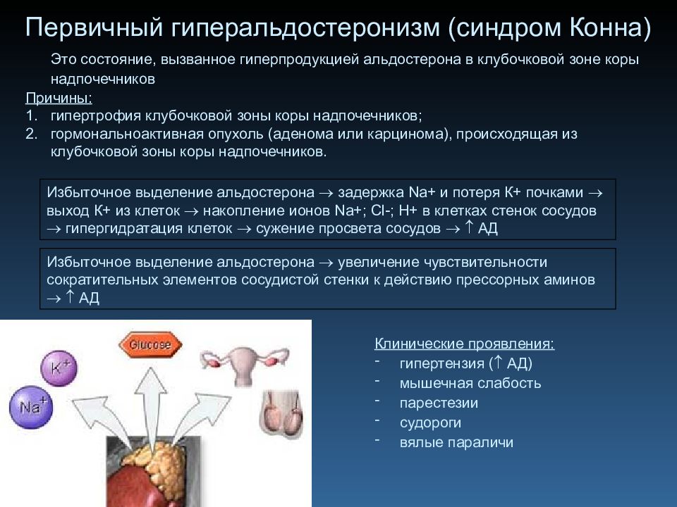 Синдром конна презентация