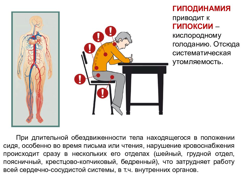 Особенно во время. Гиподинамия приводит к. Гиподинамия таблица. Гиподинамия мышц. Влияние гиподинамии на мышцы спины.