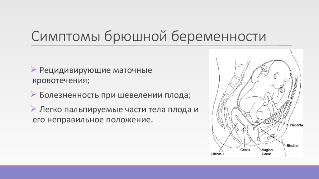 Эктопическая беременность презентация