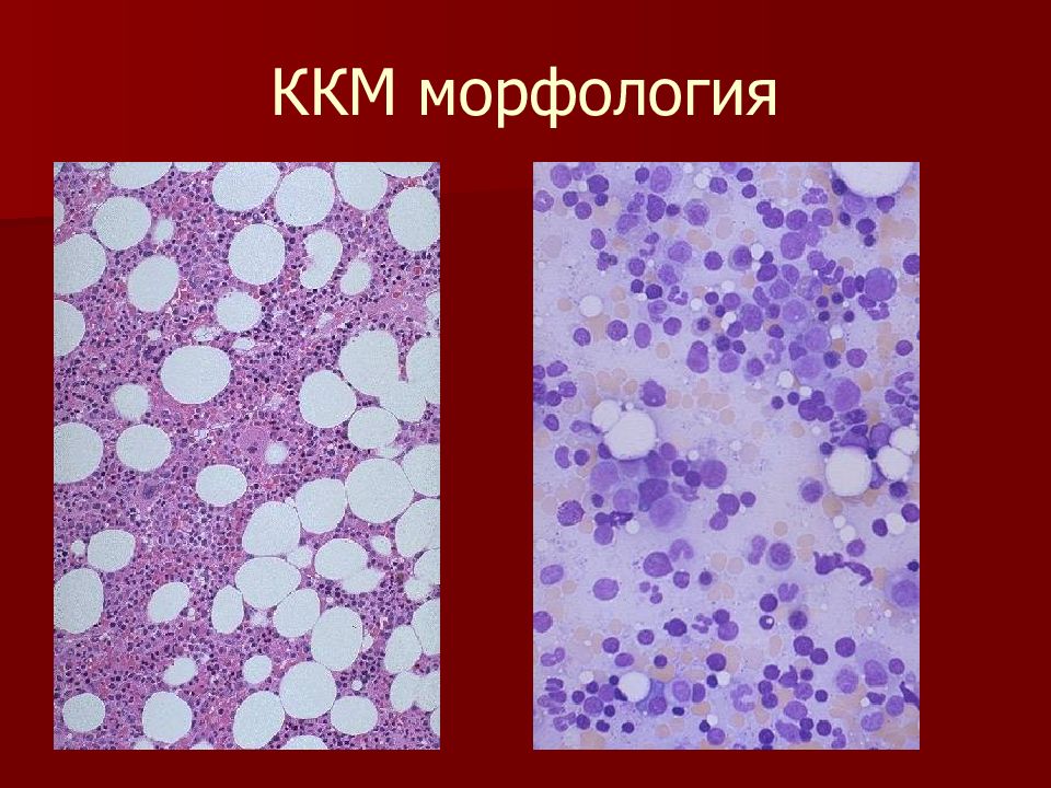 Патология крови презентация