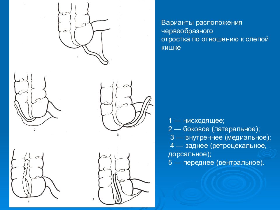 Проекция слепой кишки