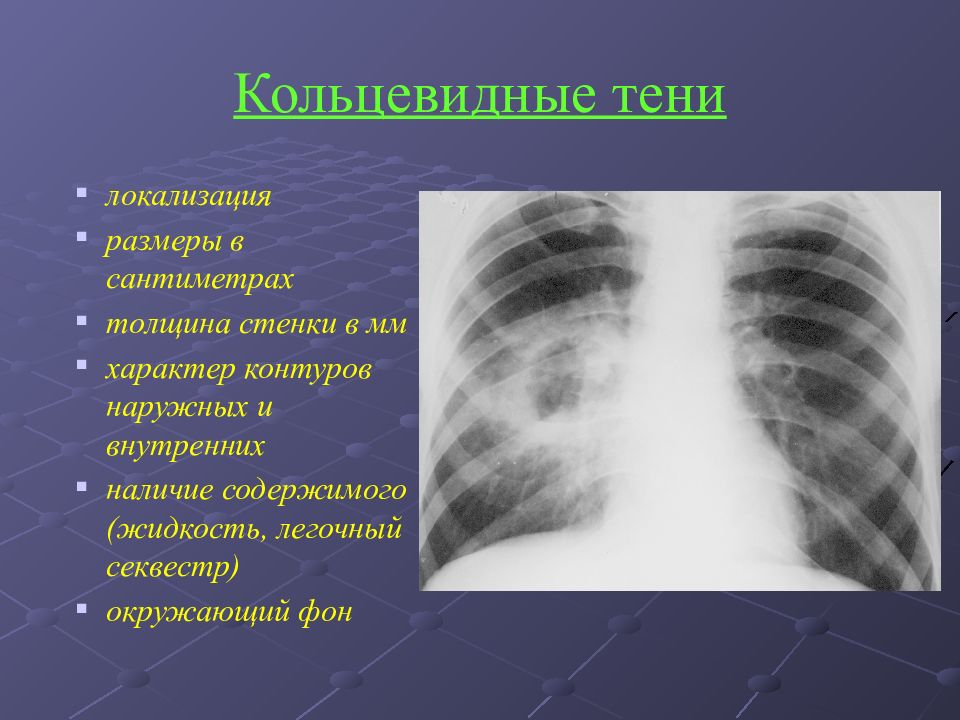 Презентации по лучевой диагностике