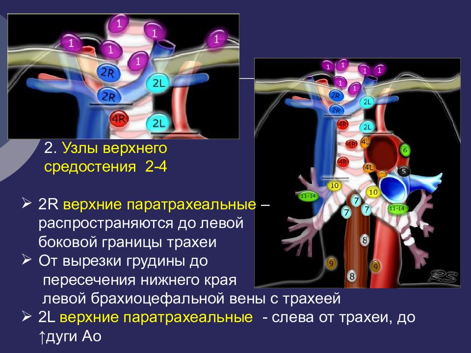 5 групп лимфоузлов. Лимфатические узлы средостения схема. Схема внутригрудных лимфоузлов. Группы лимфоузлов средостения схема. Внутригрудные лимфатические узлы.