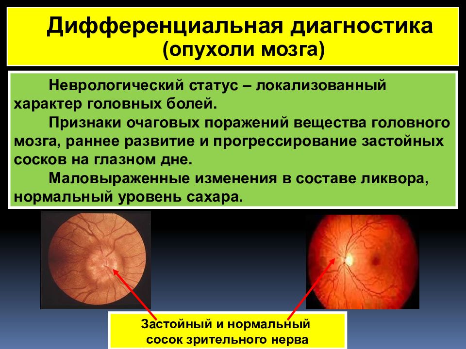 особенности очаговых поражений мозга у детей