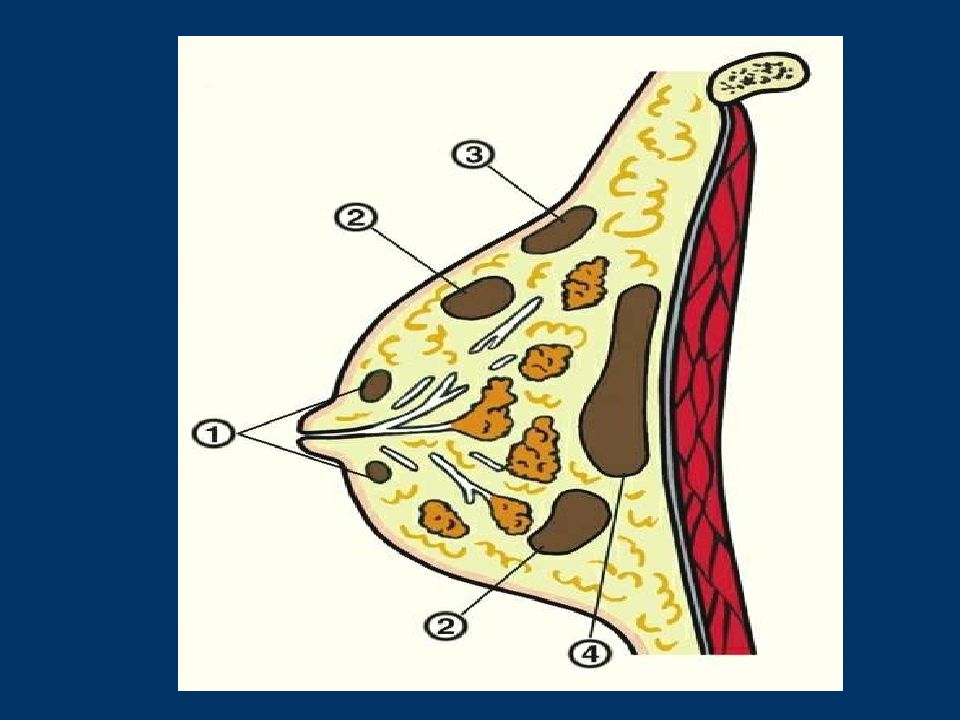 Молочные железы презентация. Ретромаммарный мастит. Молочная железа анатомия. Анатомия молочной железы хирургия.