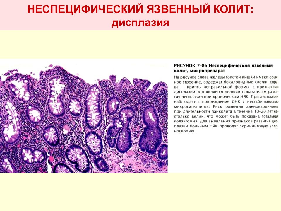 Воспаление патанатомия презентация