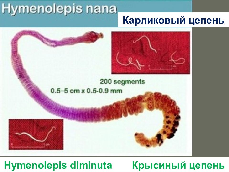 Карликовый цепень клиническая картина