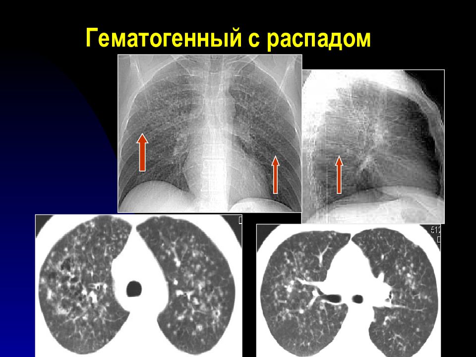 Лучевая диагностика органов дыхания презентация