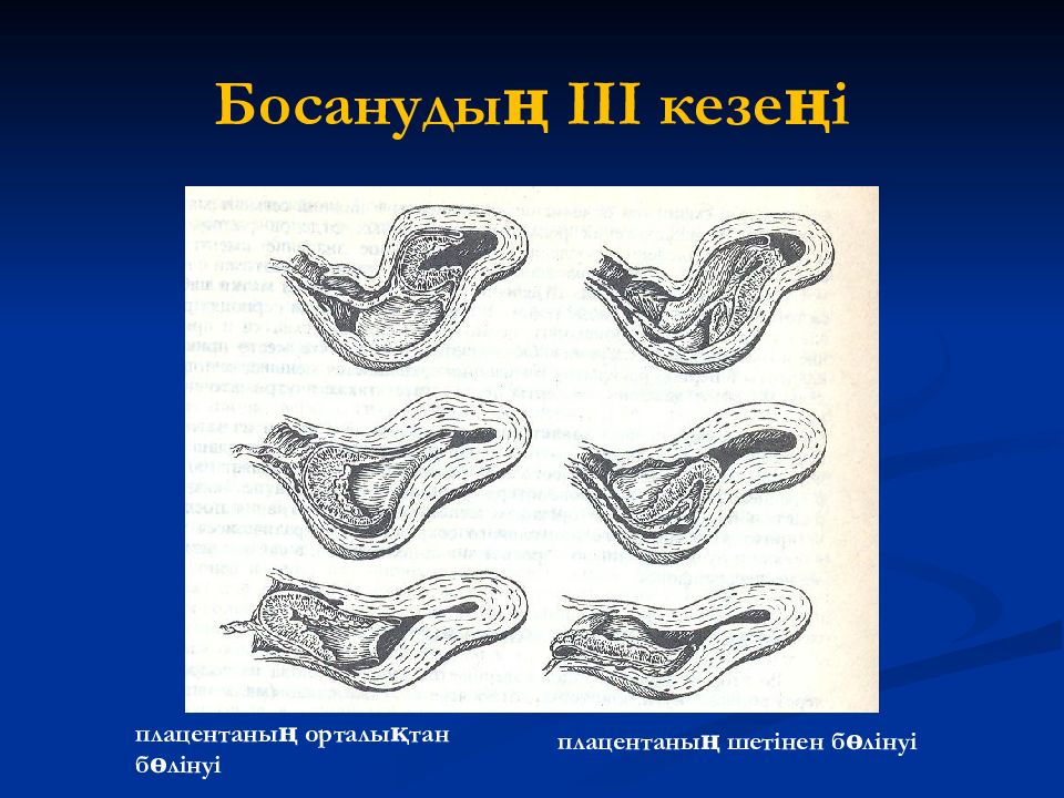 Босану физиологиясы презентация