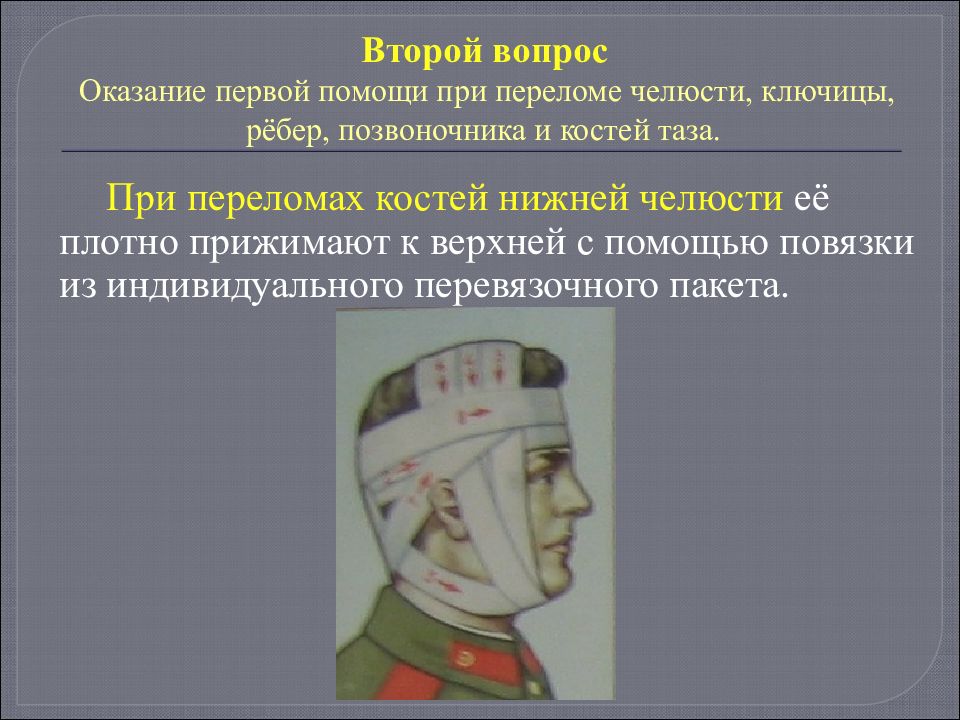 Первая медицинская помощь при ранении головы. Первая помощь при переломе челюсти. Первая помощь при переломе нижней челюсти. Повязка при переломе верхней и нижней челюсти. ПМП при переломе челюсти.