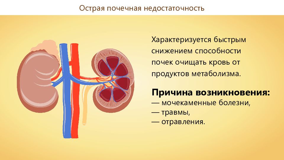 Заболевания органов мочевыделения презентация