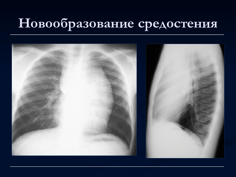 Лучевая диагностика органов дыхания презентация