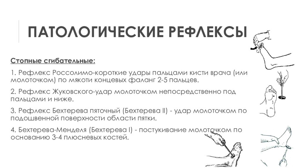 Патологические рефлексы. Патологические стопные рефлексы. Патологические кистевые рефлексы. Патологические рефлексы в неврологии. Патологический рефлекс Бехтерева.