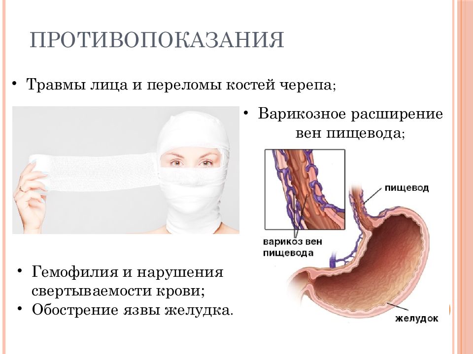 Назогастральный зонд презентация