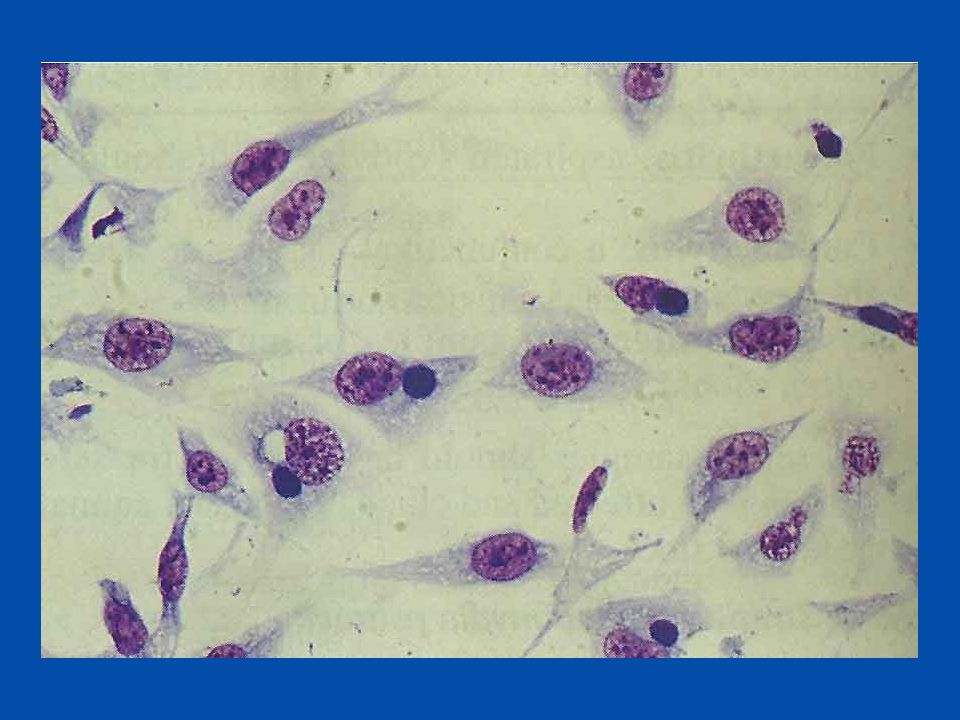Хламидия trachomatis. Урогенитальный хламидиоз микроскопия. Хламидия трахоматис под микроскопом. Урогенитальный хламидиоз микробиология.