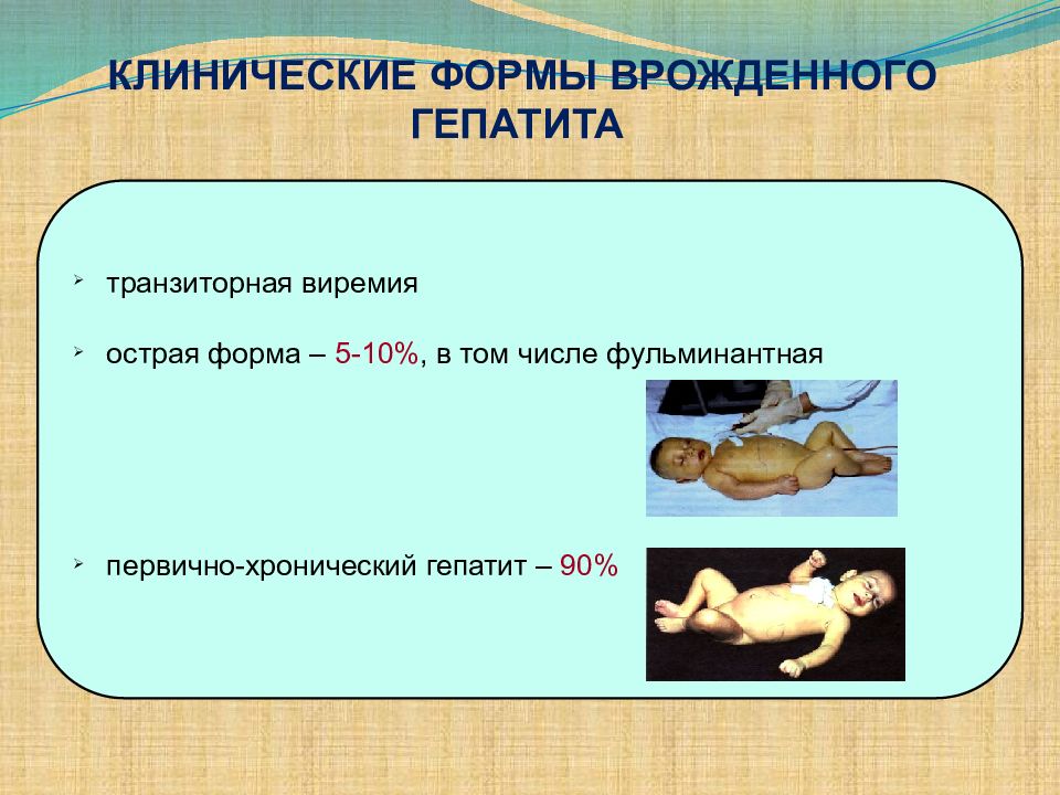 Гепатит с у детей презентация