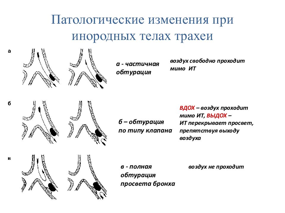 Презентация инородные тела глотки