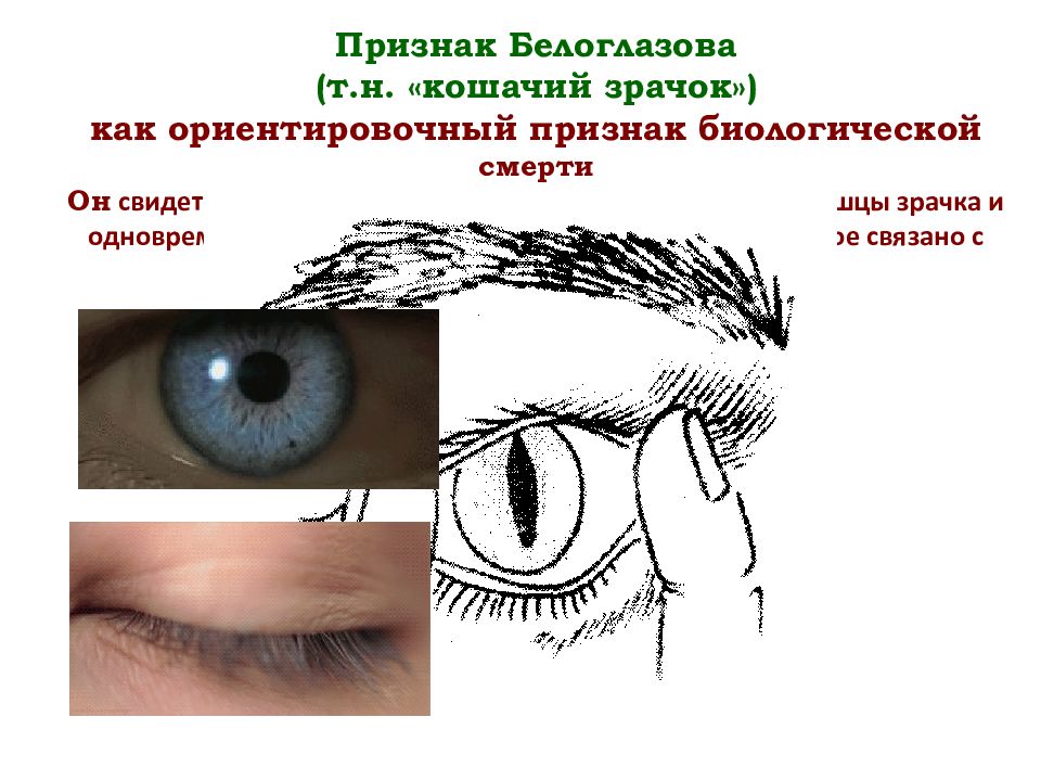 Признаки глазков