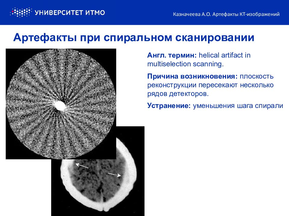 Артефакты кт изображений