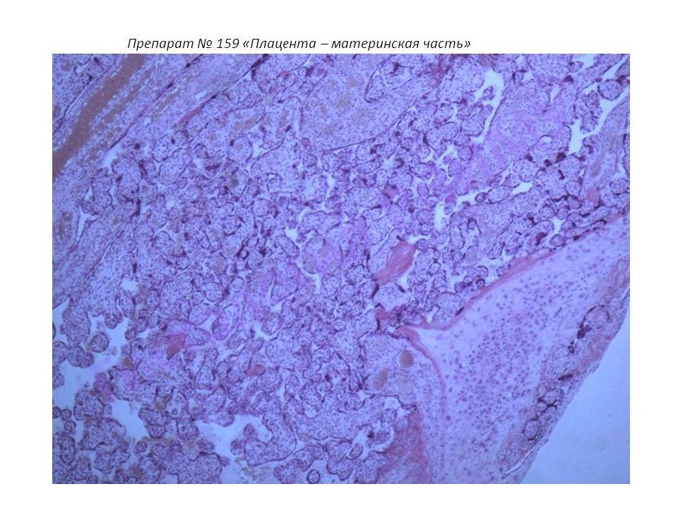 Плацента гистология. Материнская часть плаценты гематоксилин эозин. Материнская часть плаценты гистология препарат. Плацента гистология препарат.
