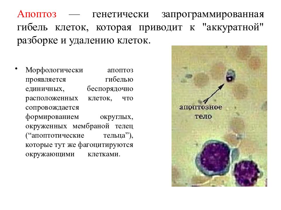 Удаление клеток. Апоптотическую гибель клеток. Гибель клетки апоптоз. Апоптоз генетически запрограммированная гибель клетки. Генетически запрограммированная смерть клетки это.