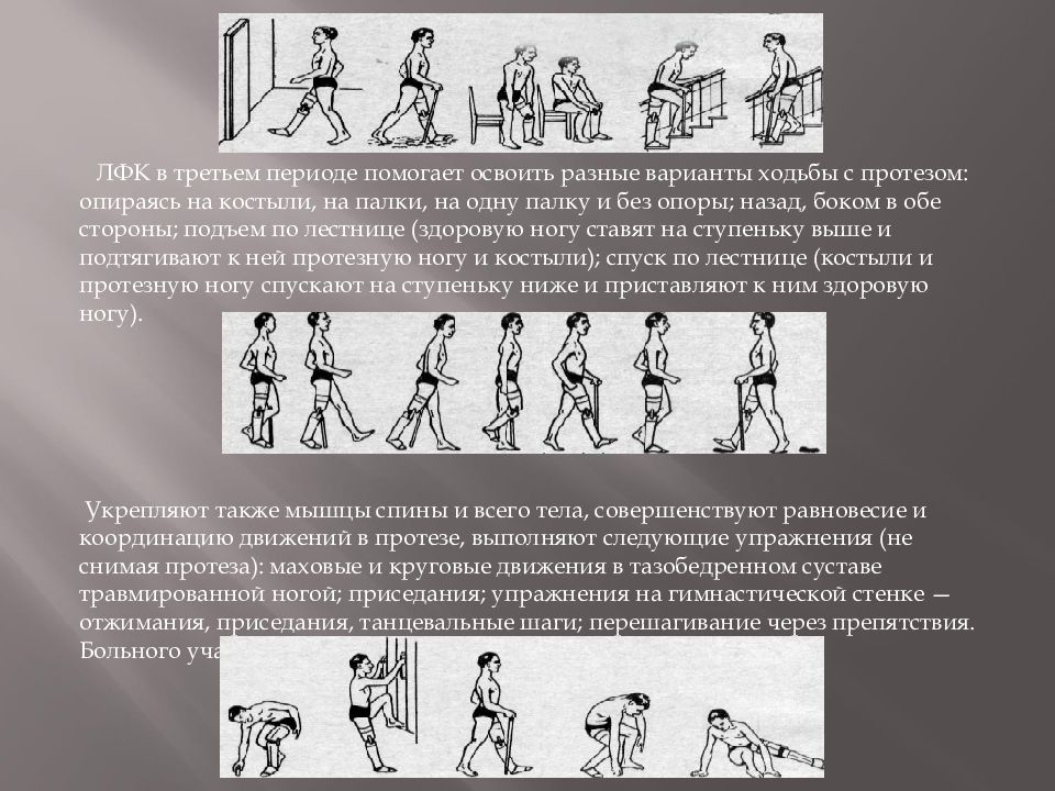 Лфк при ампутации