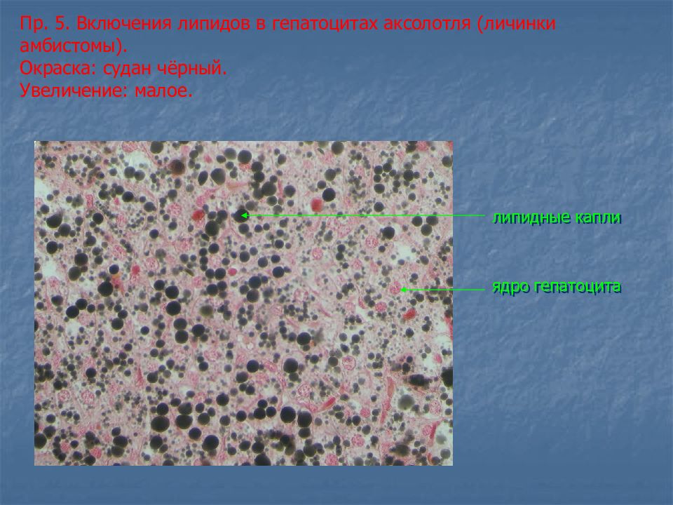 Увеличенная малая. Липидные включения (окраска Суданом). Окраска липидов Суданом черным. Окраска Суданом гистология. Судан 4 окраска липидов.