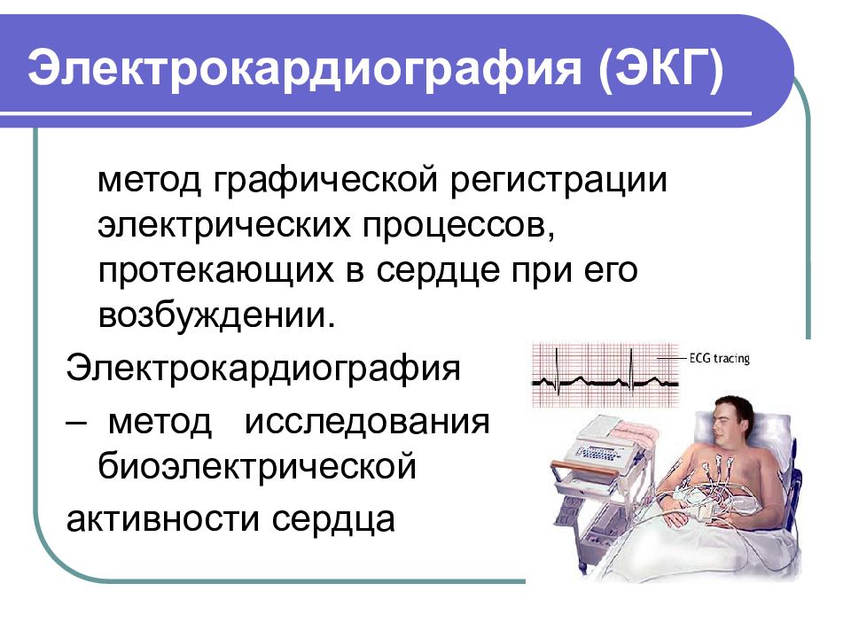 Основы экг презентация