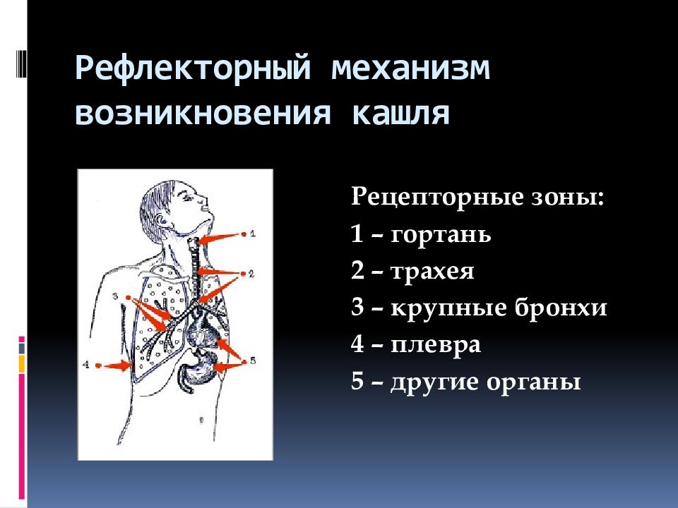 Механизм действия кашля. Механизм кашля. Механизм образования кашля. Механизм возникновения кашлевого рефлекса. Механизм появления кашля.