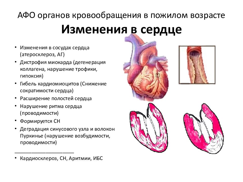 Кардиосклероз что это такое простыми словами. Анатомо-физиологические особенности органов кровообращения. Возрастные изменения системы кровообращения в пожилом возрасте.. Афо органов кровообращения в пожилом возрасте.