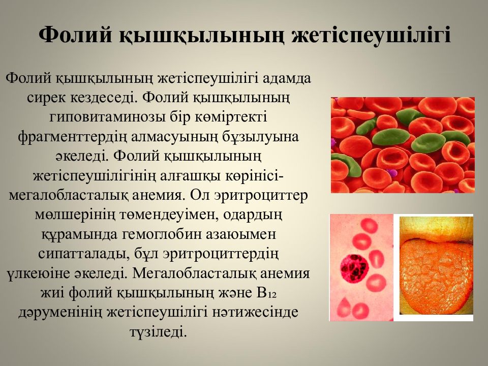 Жеке аминқышқылдардың алмасуы және оның бұзылуының биохимиялық негіздері Фолий қышқылының жетіспеушілігі