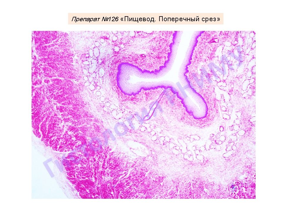 Пищевод гистология. Пищеварительная система гистология препараты. Пищеварительная система гистология. Гистологические препараты пищеварительной системы. Пищеварительная трубка гистология препарат.
