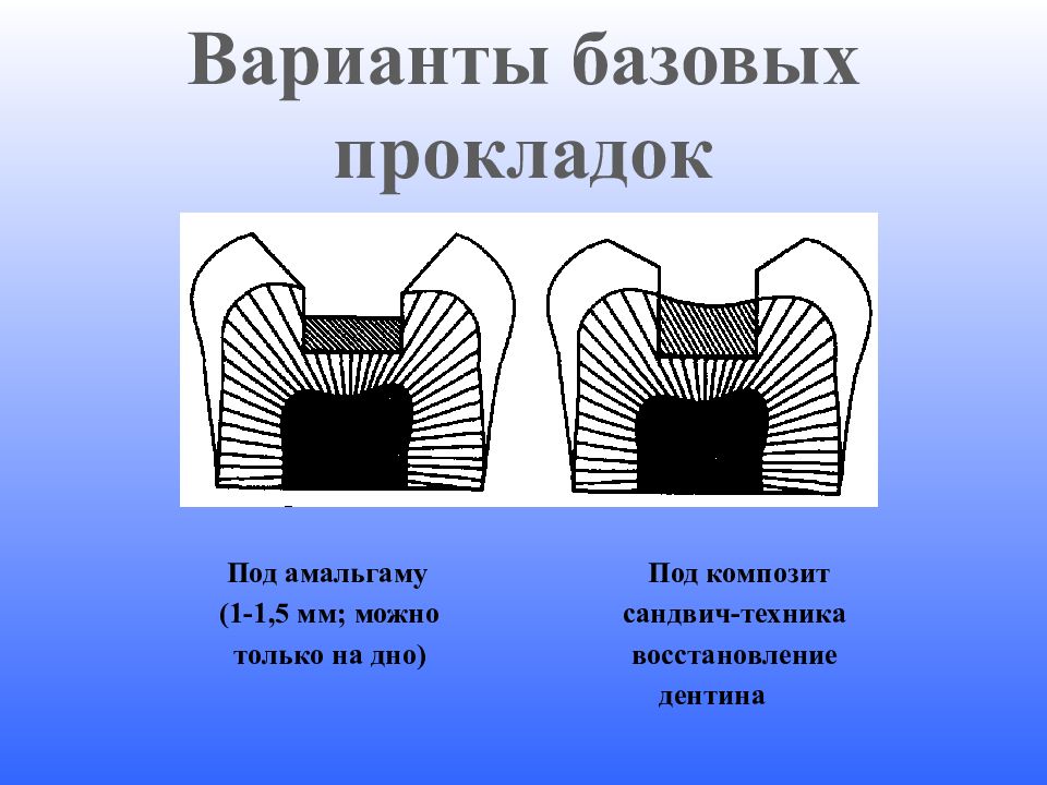 Лечебные и изолирующие прокладки в стоматологии презентация