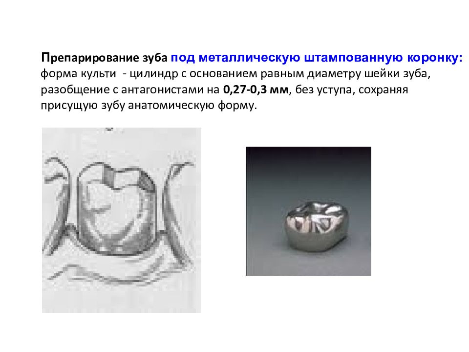 Штампованные коронки презентация