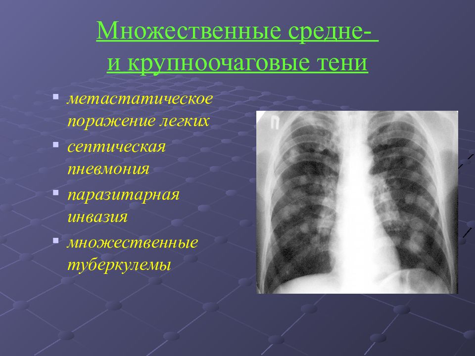 Лекарственные поражения легких презентация