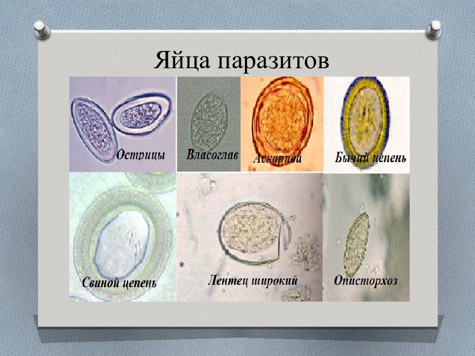 Яйцо паразита рисунок. Яйца паразитов под микроскопом. Типы яиц паразитов. Яйца паразитических червей.