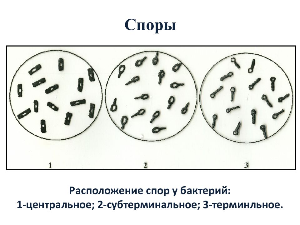 Форма спор бактерий. Варианты расположения спор микробиология. Расположение спор у бацилл. Споры бактерий микробиология. Споры бактерий расположение.