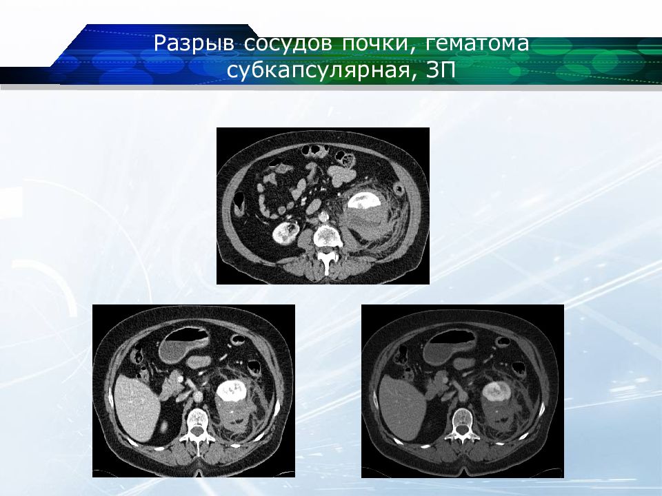 Кт почек презентация