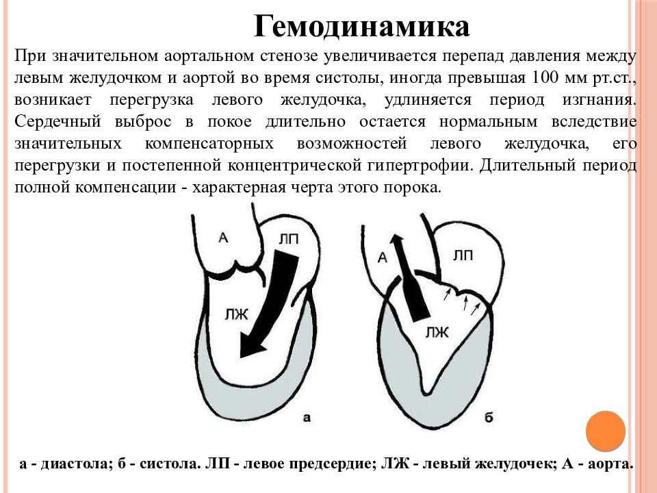 Нарушения левого желудочка. Аортальная недостаточность гемодинамика схема. Стеноз аортального клапана гемодинамика схема. Схемы изменений гемодинамики при аортальной недостаточности. Гемодинамика при врожденных пороках сердца схема.